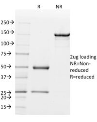 Data from SDS-PAGE analysis of Anti-Mammaglobin antibody (Clone MGB1/2000). Reducing lane (R) shows heavy and light chain fragments. NR lane shows intact antibody with expected MW of approximately 150 kDa. The data are consistent with a high purity, intact mAb.